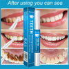 Okenys Teeth Whitening Pen