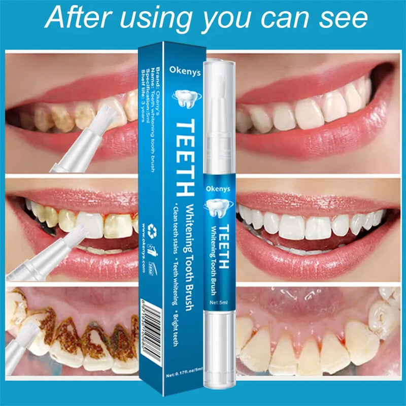 Okenys Teeth Whitening Pen